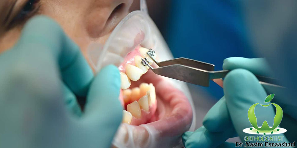 متخصص ارتودنسی اصفهان