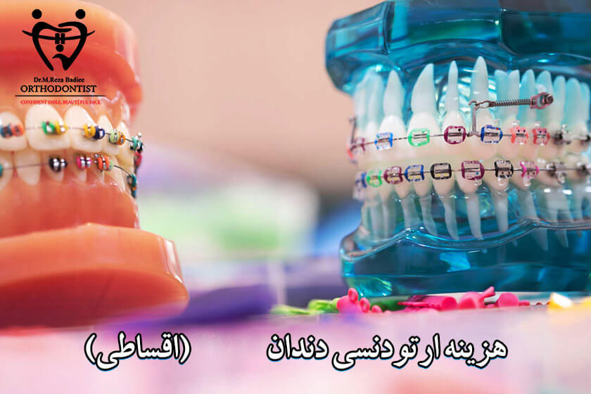 قیمت ارتودنسی در تهران