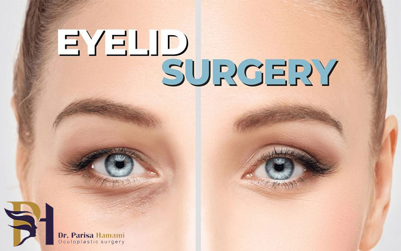 جراح پلک تهران