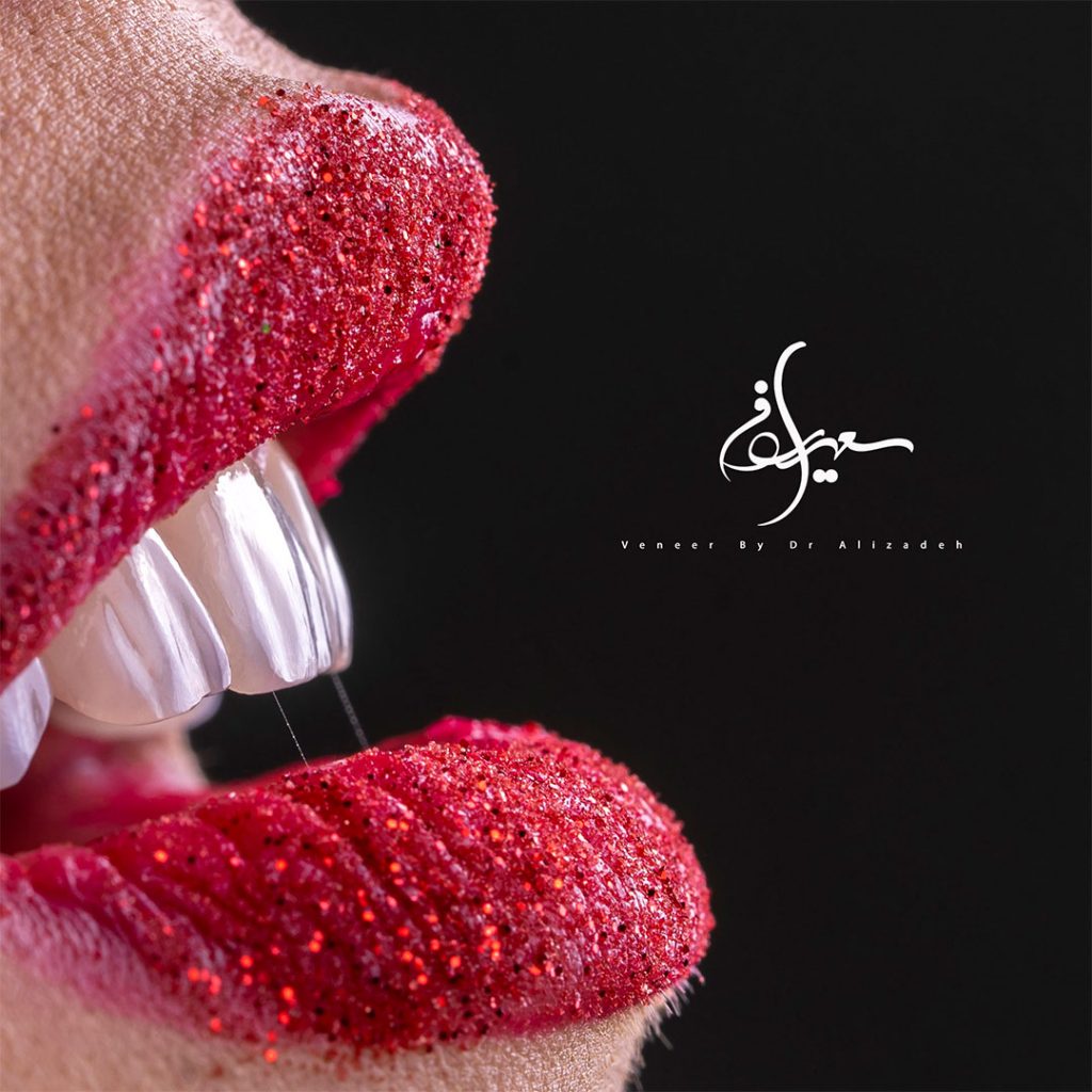 عکاسی دندانپزشکی