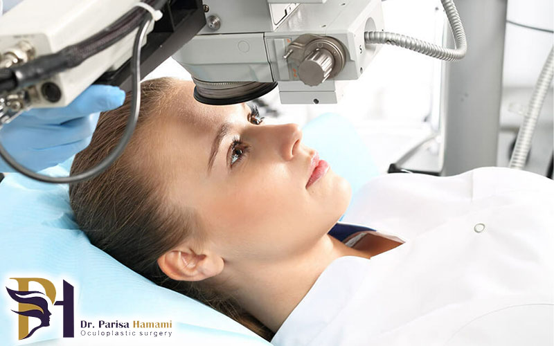 عمل لیزیک چشم